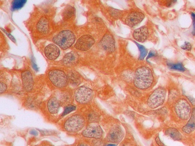 连环蛋白β1(β-catenin)单克隆抗体