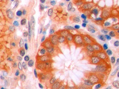 连环蛋白β1(β-catenin)单克隆抗体