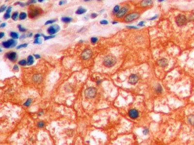 连环蛋白β1(β-catenin)单克隆抗体