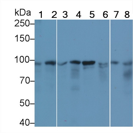 連環(huán)蛋白β1(β-catenin)單克隆抗體