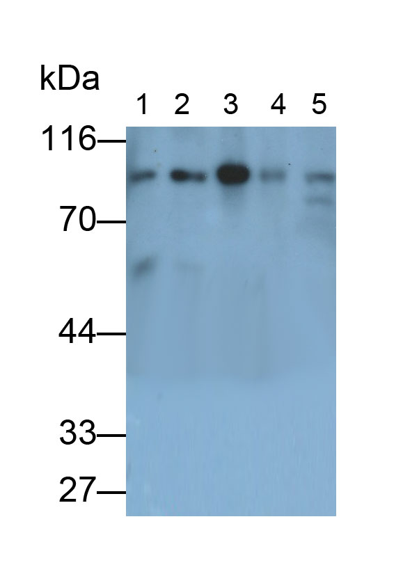 连环蛋白β1(β-catenin)单克隆抗体