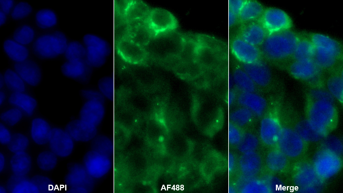白蛋白(ALB)單克隆抗體
