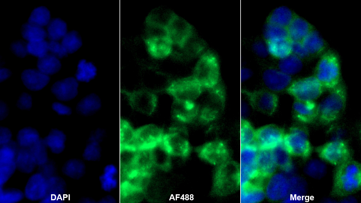 白蛋白(ALB)單克隆抗體