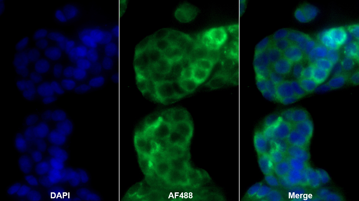 白蛋白(ALB)單克隆抗體