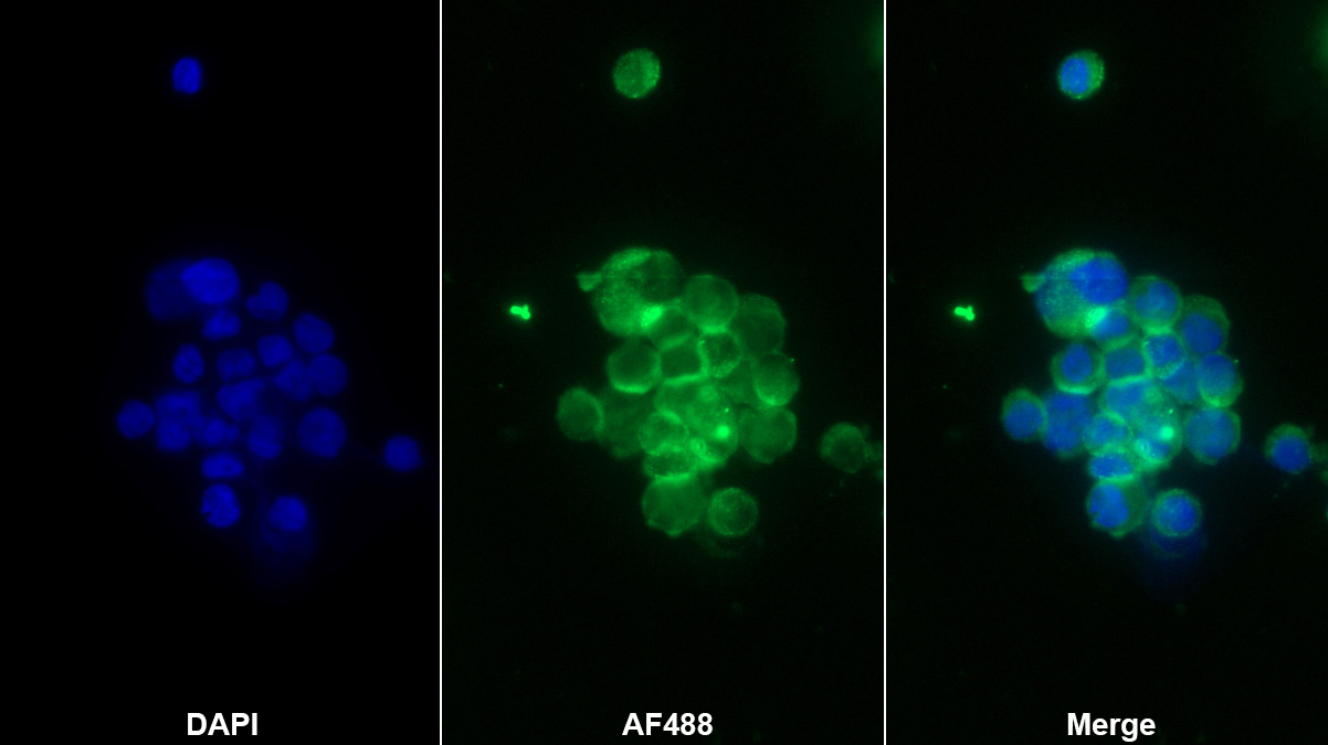 蛋白酪氨酸磷酸酶受體C(CD45)單克隆抗體