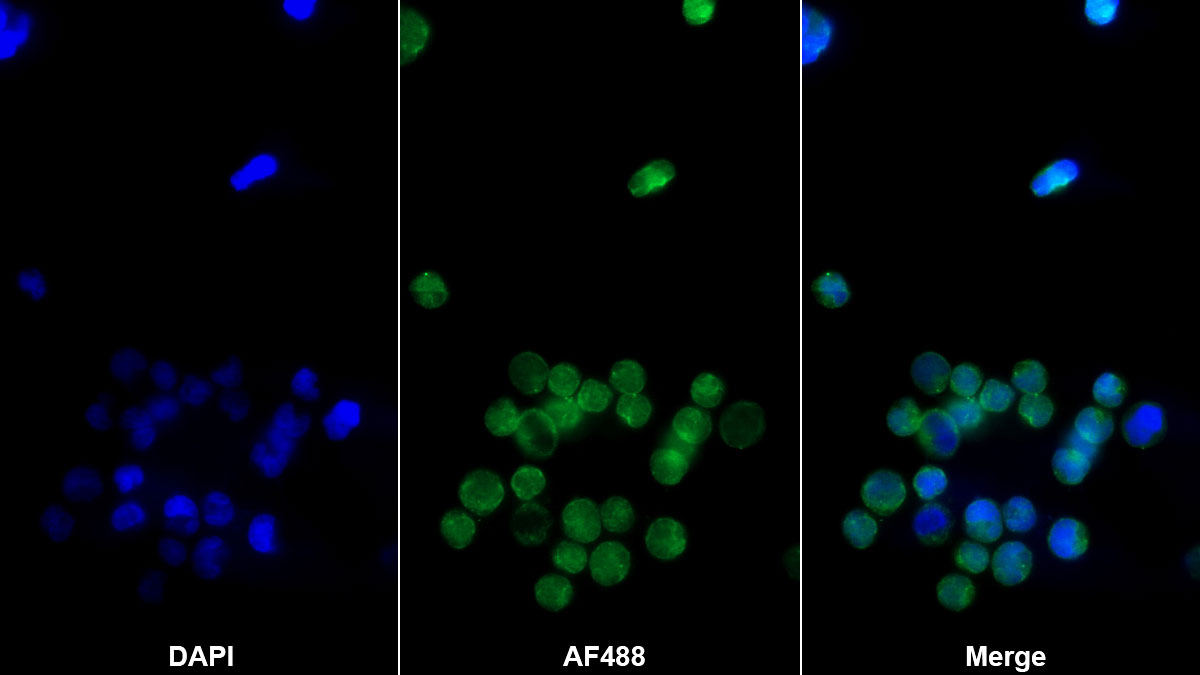 CD8a分子(CD8a)單克隆抗體