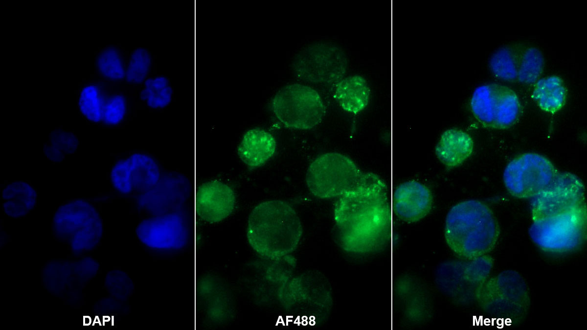 CD8a分子(CD8a)单克隆抗体