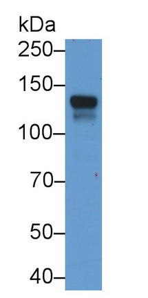 唾液酸結合Ig樣凝集素2(CD22)單克隆抗體
