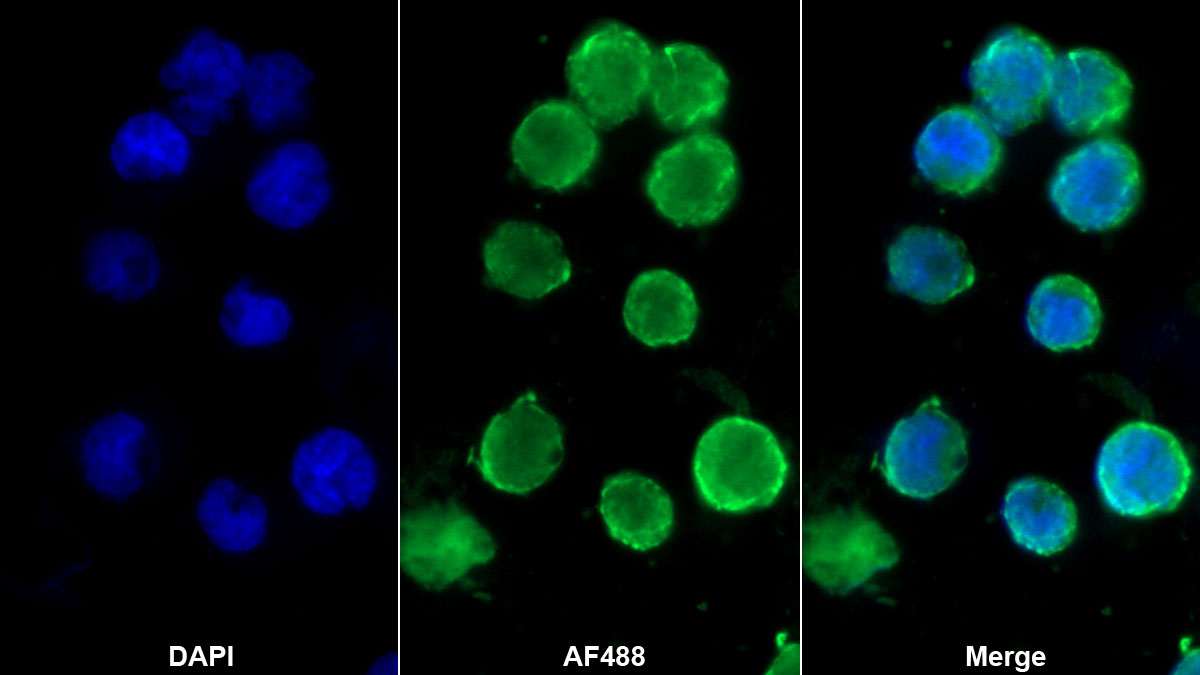 CD4分子(CD4)單克隆抗體