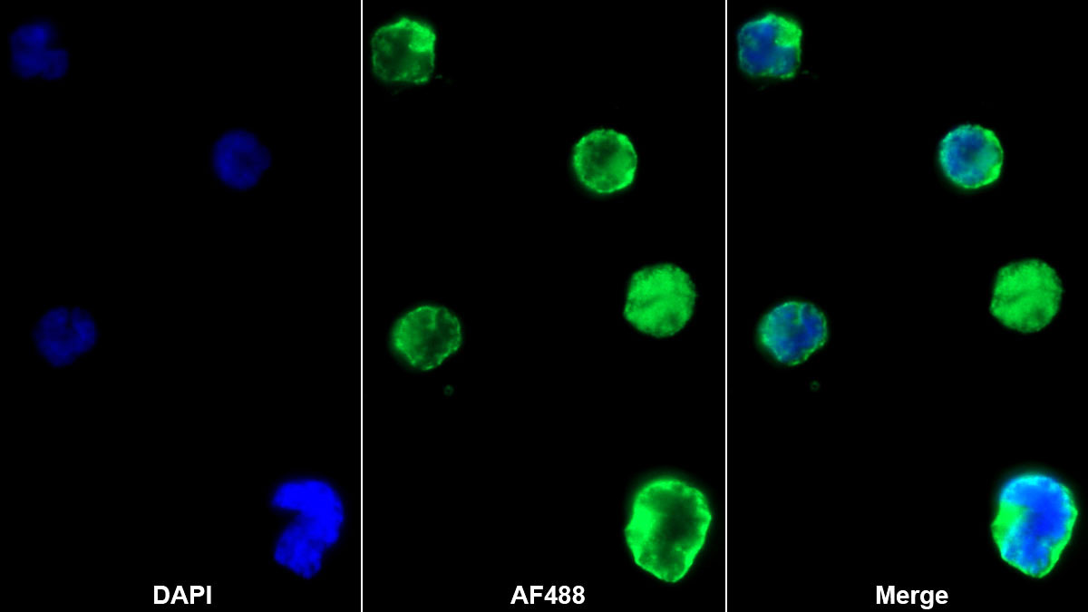 CD4分子(CD4)單克隆抗體