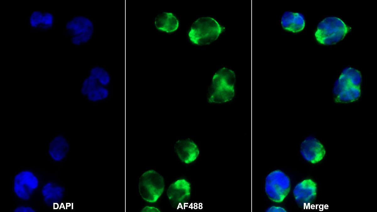 CD4分子(CD4)单克隆抗体