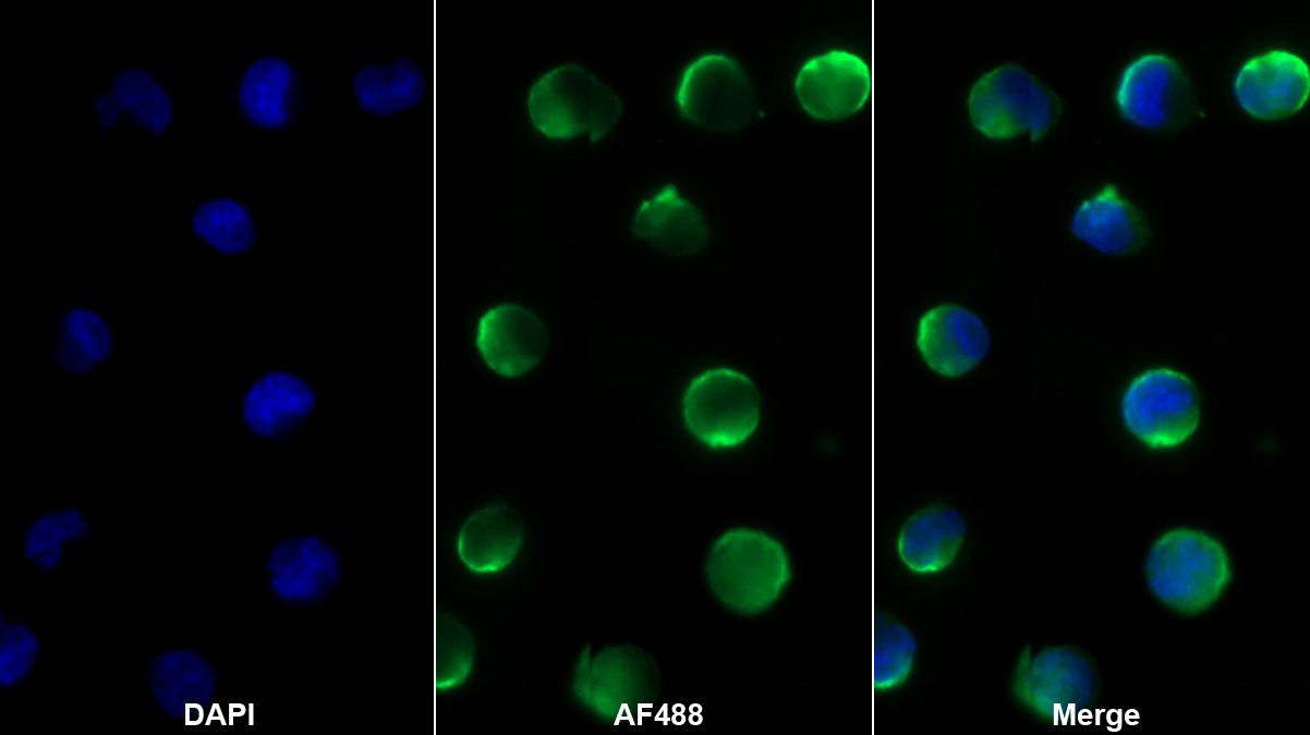 CD1a分子(CD1a)单克隆抗体
