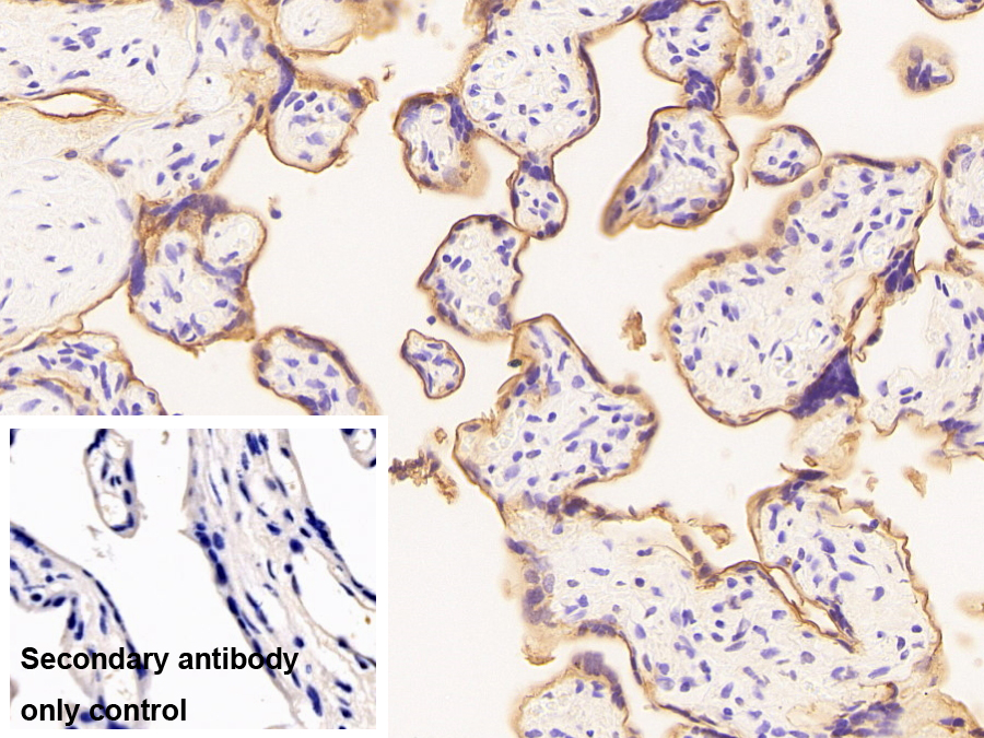 胎盤堿性磷酸酶(ALPP)單克隆抗體