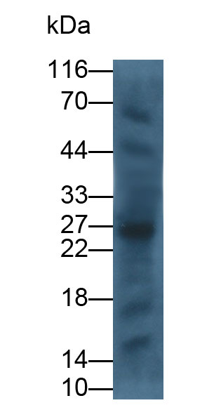 细胞毒性T-淋巴细胞关联抗原4(CTLA4)单克隆抗体