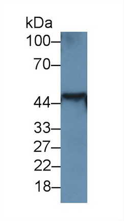 角蛋白18(CK18)單克隆抗體