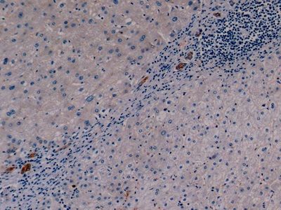 角蛋白19(CK19)单克隆抗体