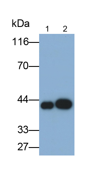 角蛋白19(CK19)单克隆抗体
