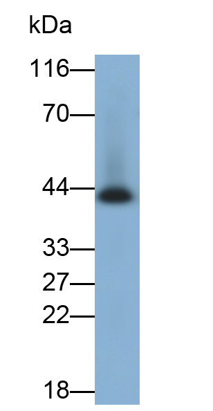 角蛋白19(CK19)單克隆抗體