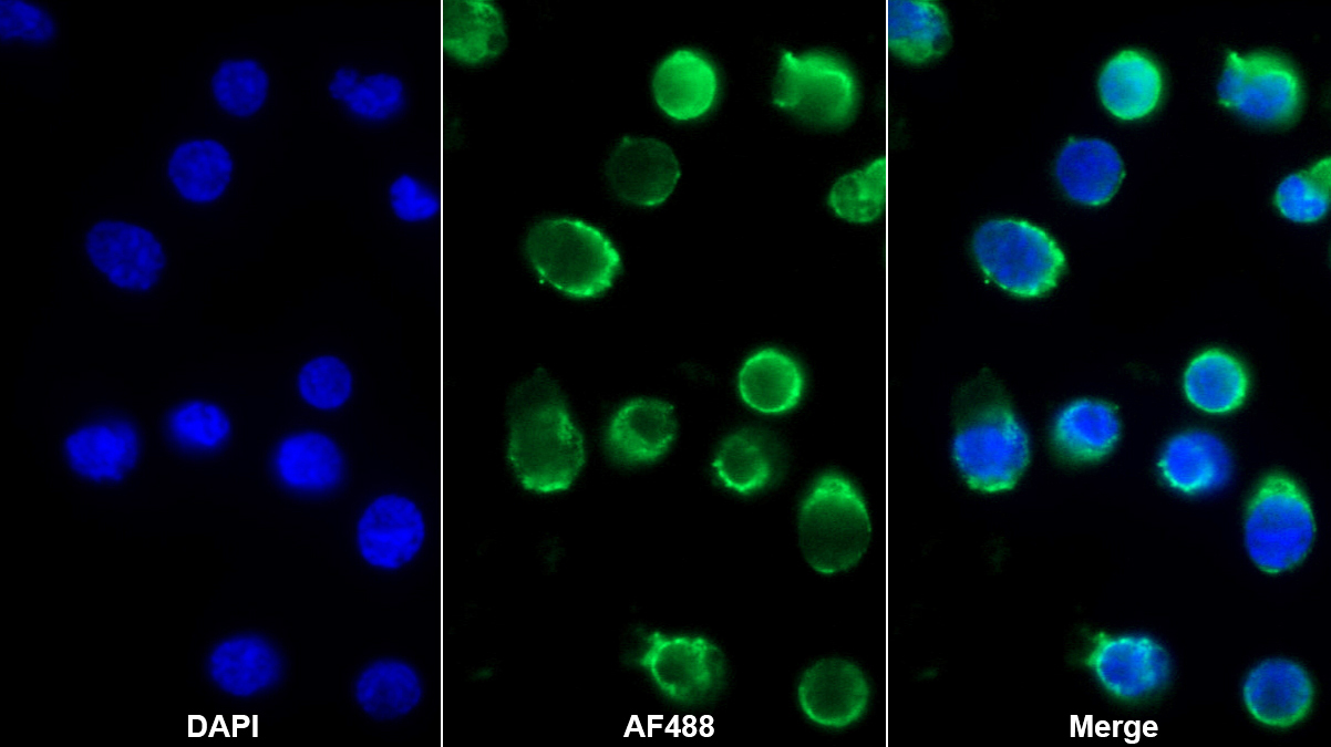 腫瘤壞死因子受體超家族成員5(CD40)單克隆抗體