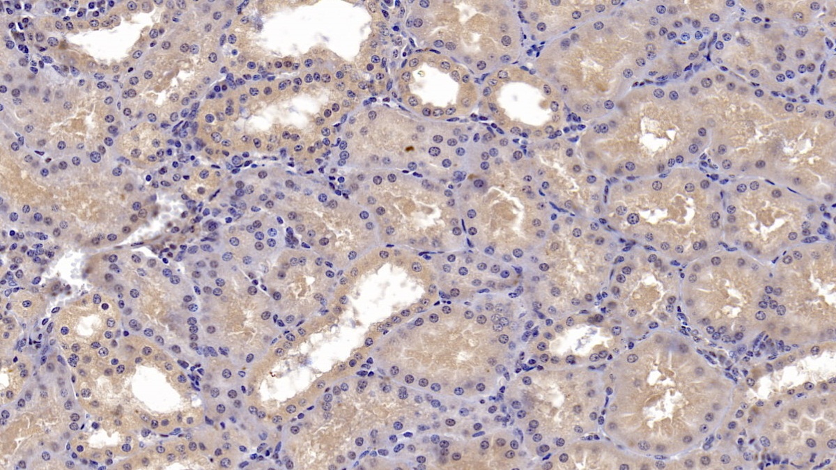 CD73分子(CD73)單克隆抗體
