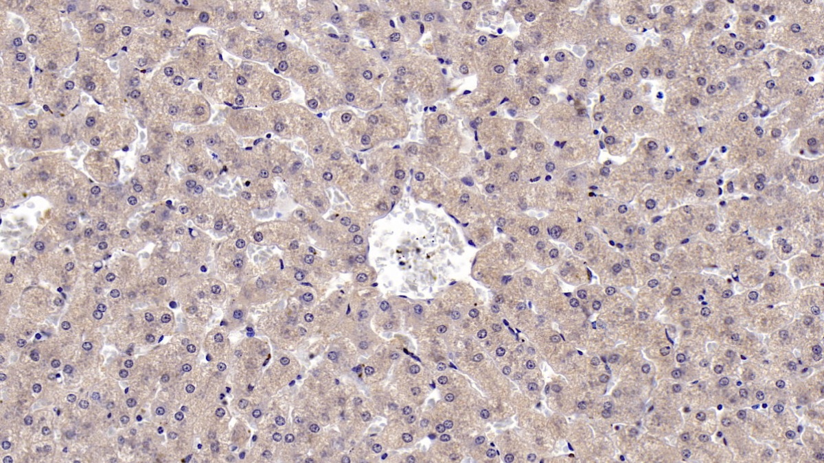 CD73分子(CD73)單克隆抗體