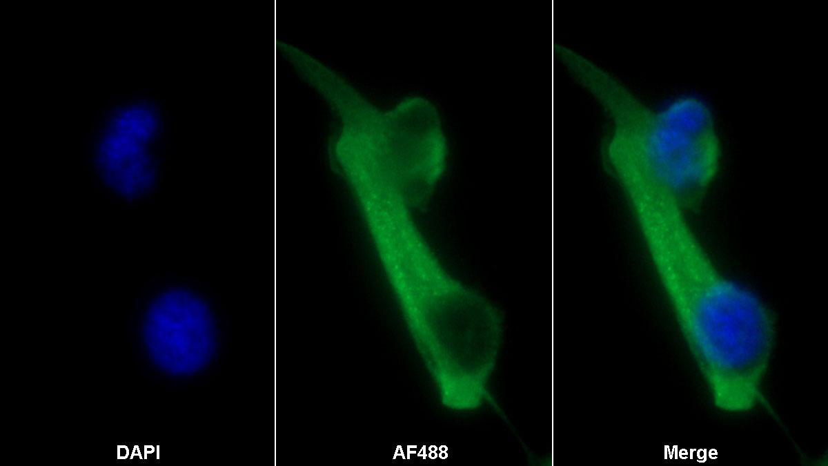 CD73分子(CD73)單克隆抗體