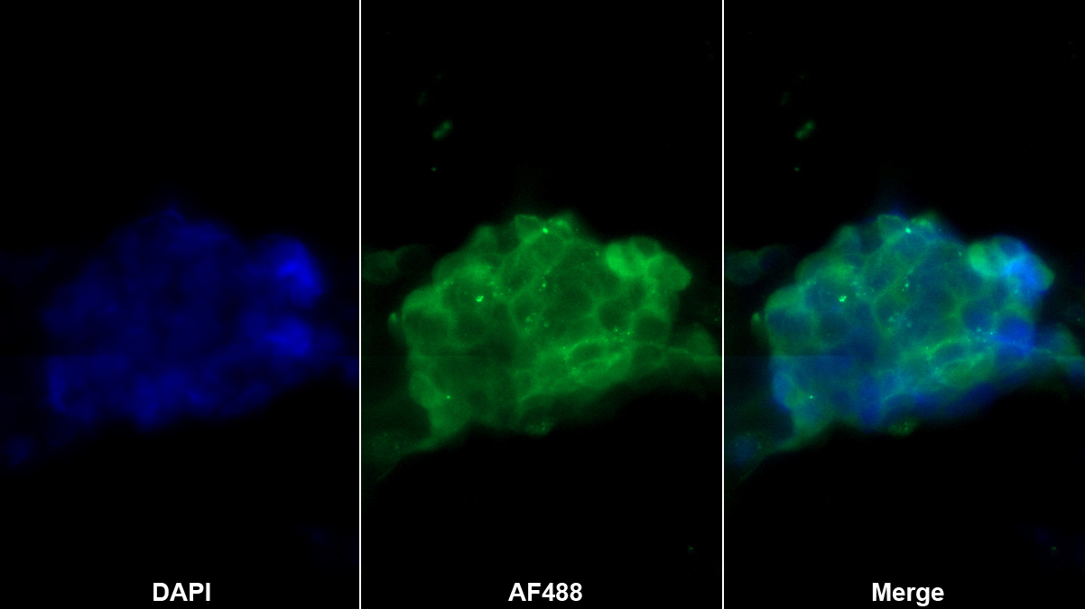 血管抑素(ANG)单克隆抗体
