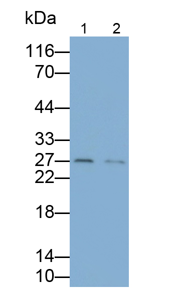 谷氨酸脫羧酶2(GAD2)單克隆抗體