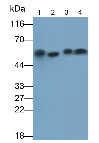 IgG-Fc片段低親和力受體Ⅲb(FcgR3B)單克隆抗體