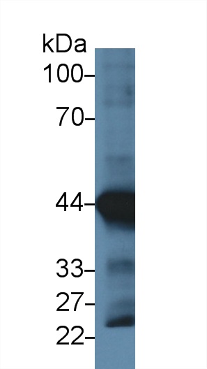 心肌肌动蛋白α1(ACTC1)单克隆抗体