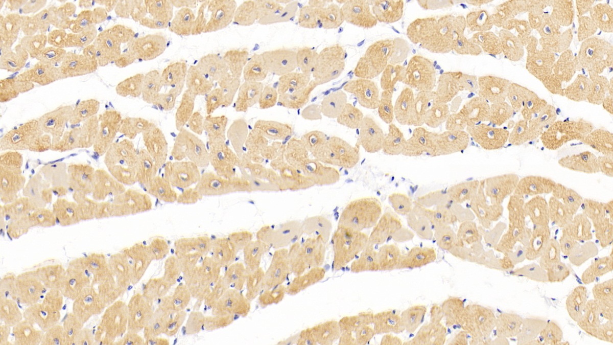 心肌肌動(dòng)蛋白α1(ACTC1)單克隆抗體