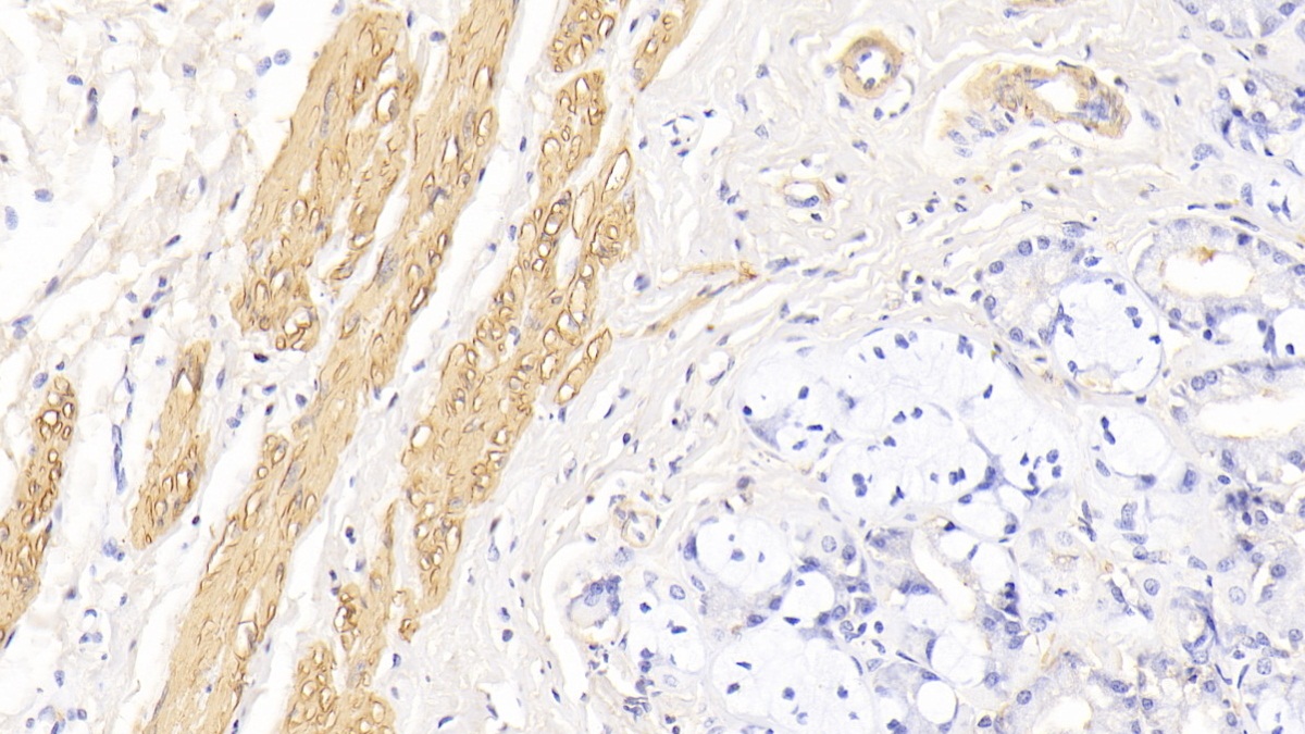心肌肌動(dòng)蛋白α1(ACTC1)單克隆抗體