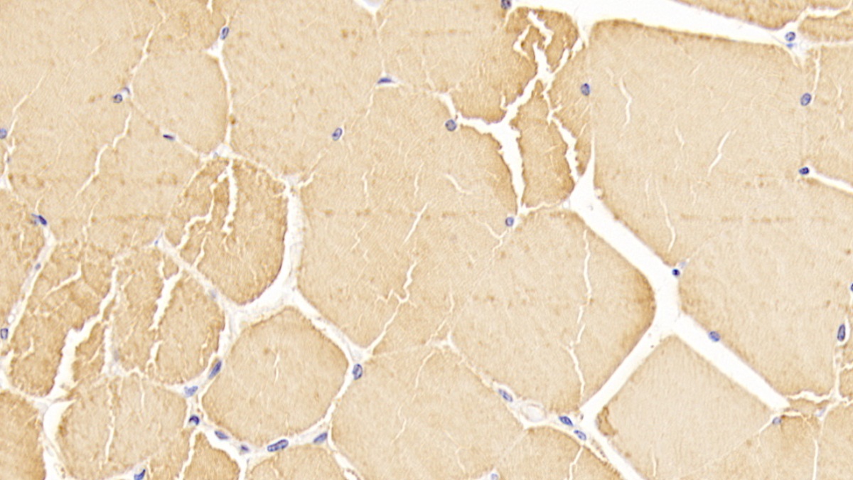 心肌肌動(dòng)蛋白α1(ACTC1)單克隆抗體