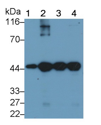 心肌肌動(dòng)蛋白α1(ACTC1)單克隆抗體