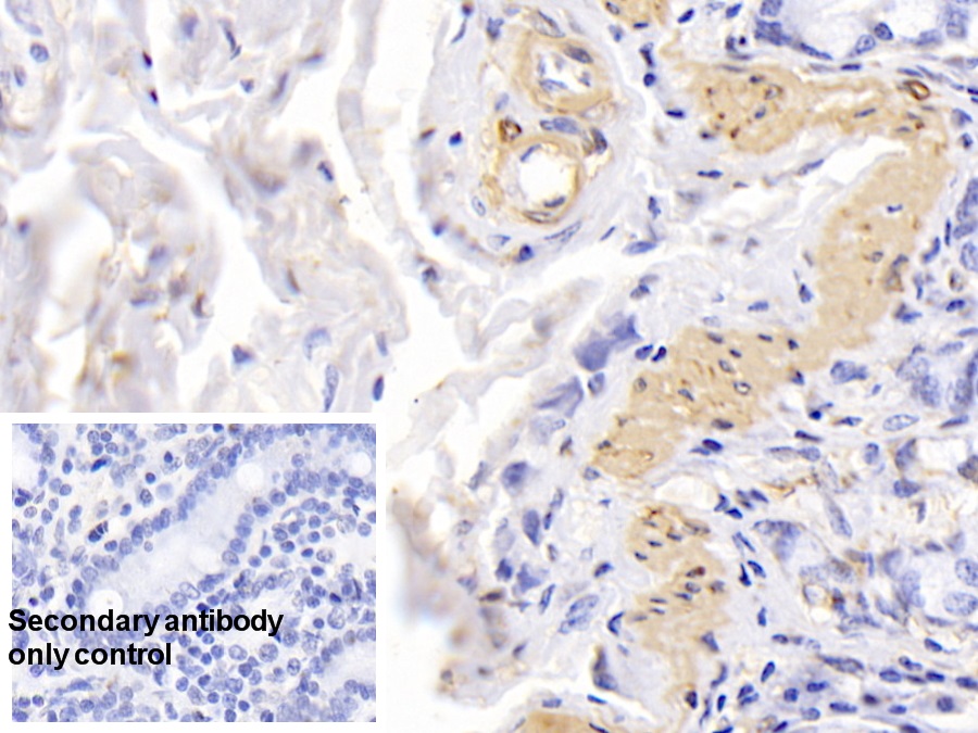 心肌肌動(dòng)蛋白α1(ACTC1)單克隆抗體