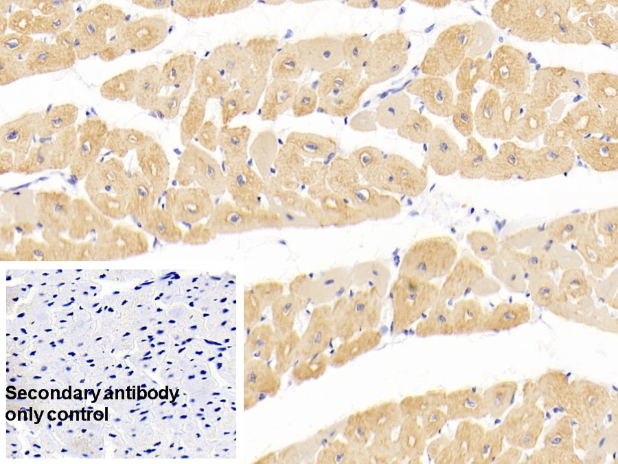 心肌肌動(dòng)蛋白α1(ACTC1)單克隆抗體