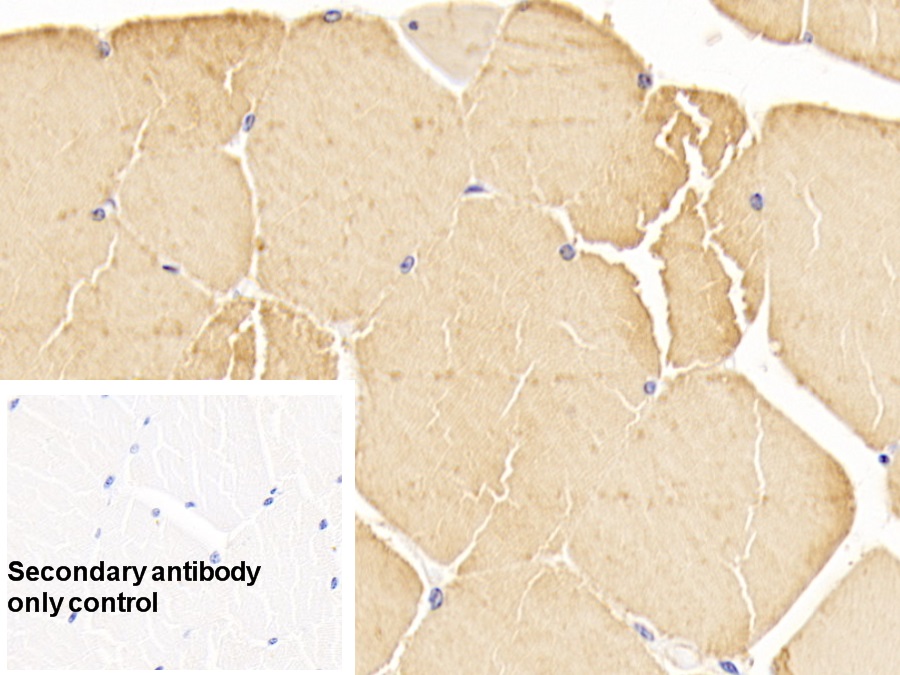 心肌肌動(dòng)蛋白α1(ACTC1)單克隆抗體
