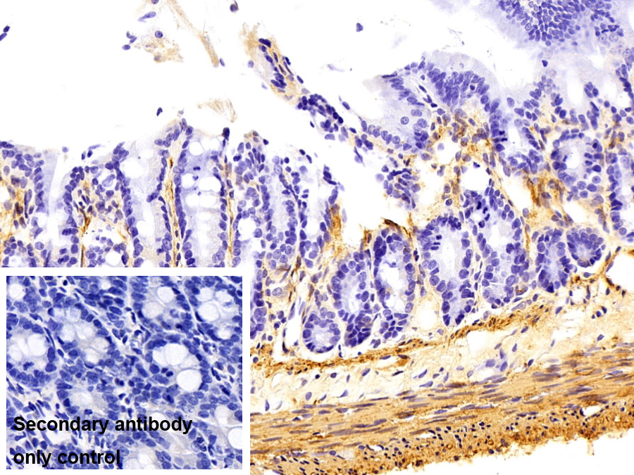 心肌肌動(dòng)蛋白α1(ACTC1)單克隆抗體