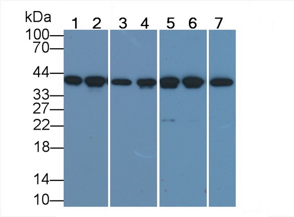 心肌肌動蛋白α1(ACTC1)單克隆抗體