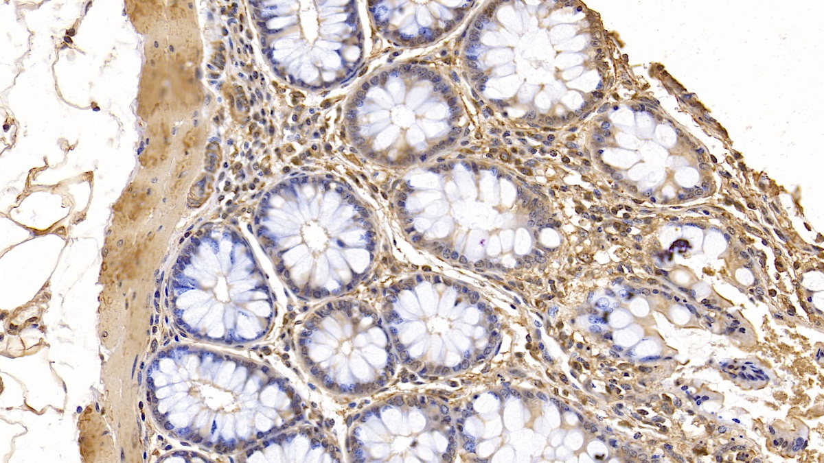心肌肌動蛋白α1(ACTC1)單克隆抗體