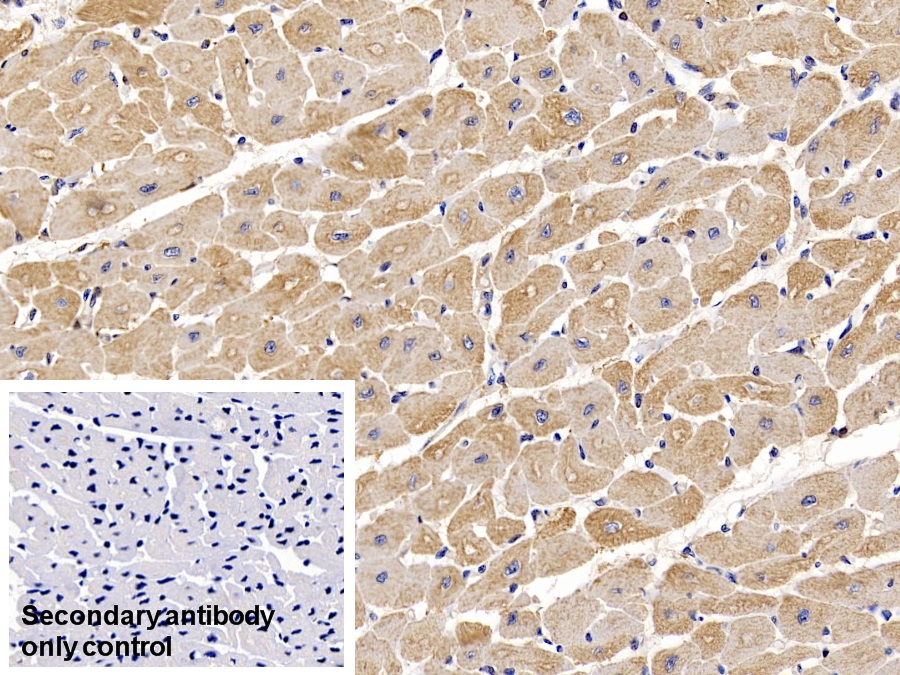 心肌肌動蛋白α1(ACTC1)單克隆抗體