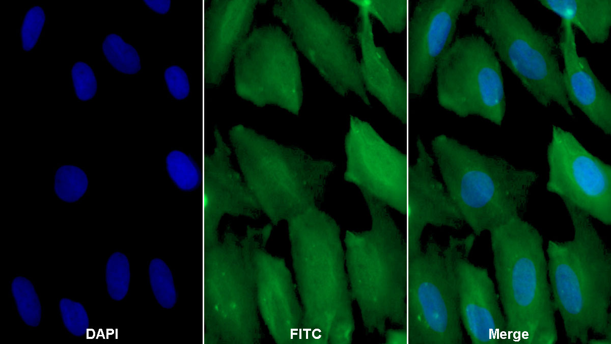 心肌肌動(dòng)蛋白α1(ACTC1)單克隆抗體