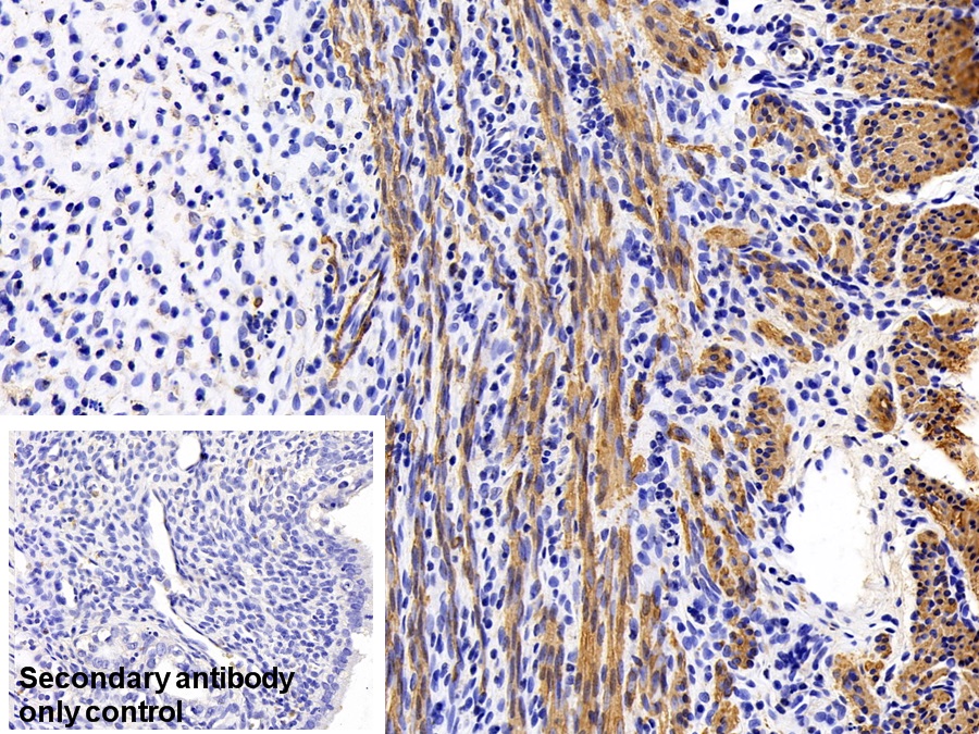 心肌肌動(dòng)蛋白α1(ACTC1)單克隆抗體