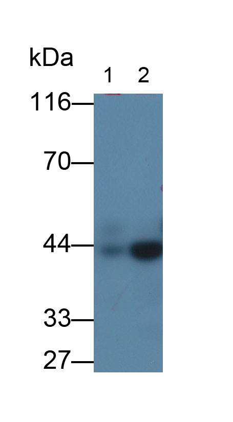 平滑肌肌動蛋白α2(ACTa2)單克隆抗體