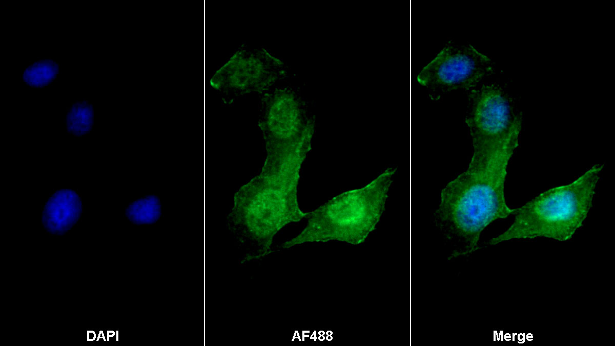 平滑肌肌動(dòng)蛋白α2(ACTa2)單克隆抗體