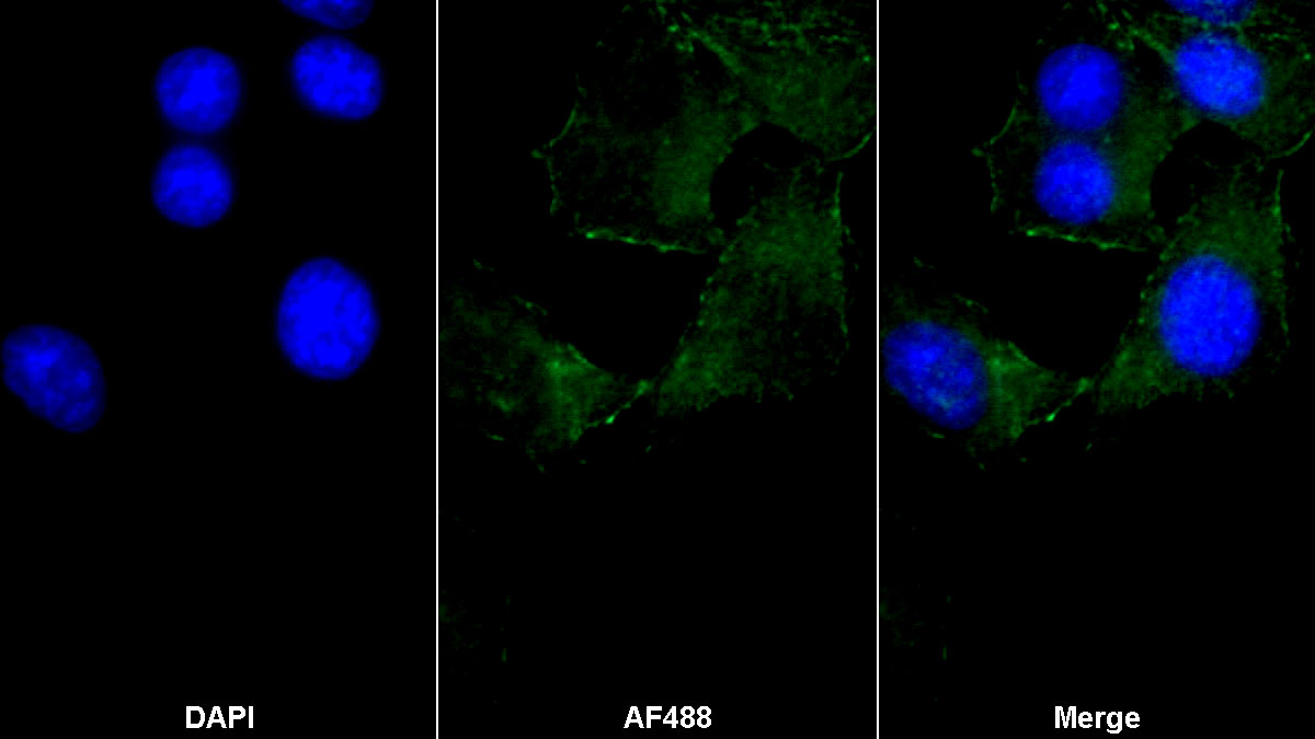 平滑肌肌動(dòng)蛋白α2(ACTa2)單克隆抗體