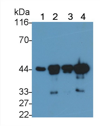 平滑肌肌动蛋白α2(ACTa2)单克隆抗体