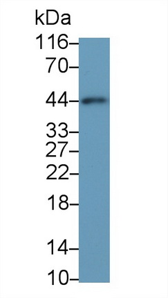 平滑肌肌動蛋白α2(ACTa2)單克隆抗體
