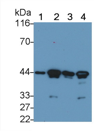 平滑肌肌動蛋白α2(ACTa2)單克隆抗體