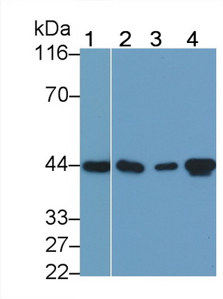平滑肌肌动蛋白α2(ACTa2)单克隆抗体